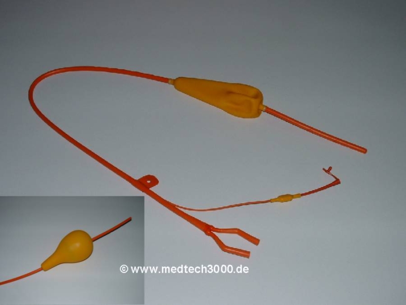 linton nachlass sonde - sengstaken blakemore sonde
